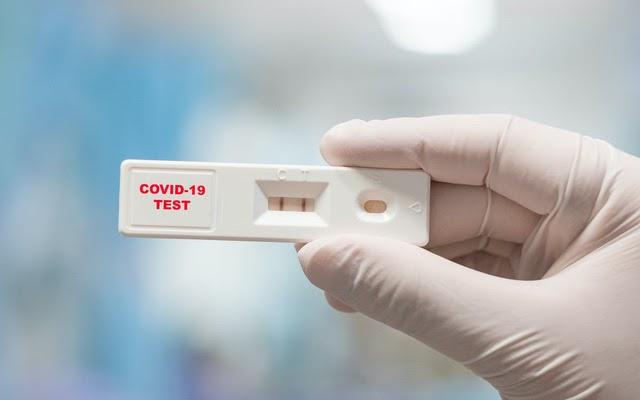 Khi tự test nhanh COVID-19 dương tính, người dân Hà Nội cần làm gì?