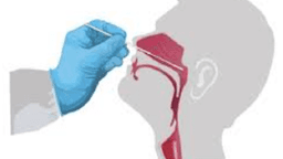 Những điều người dân cần lưu ý khi tự làm test nhanh COVID-19 tại nhà